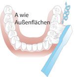 Au&szlig;enfl&auml;chen-Putztechnik