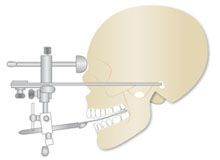 Gesichtsbogen gesichtsbogen